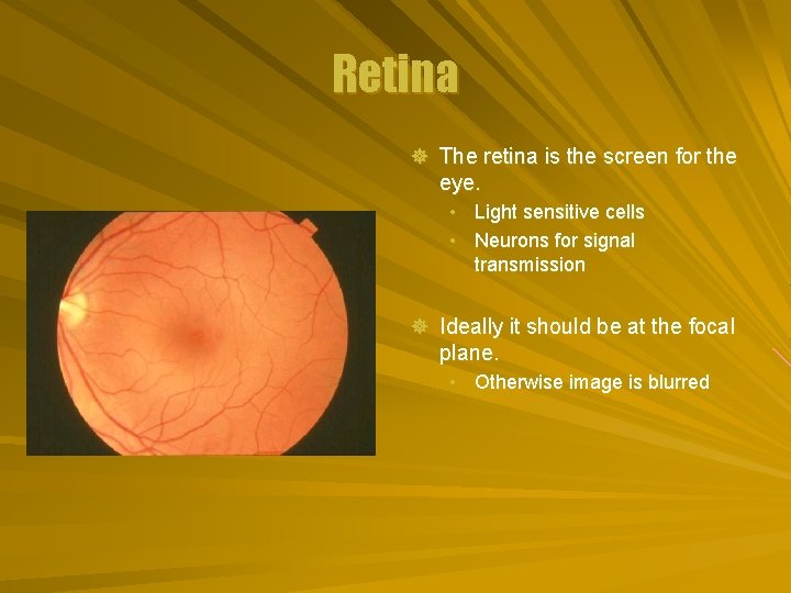 Retina ] The retina is the screen for the eye. • Light sensitive cells