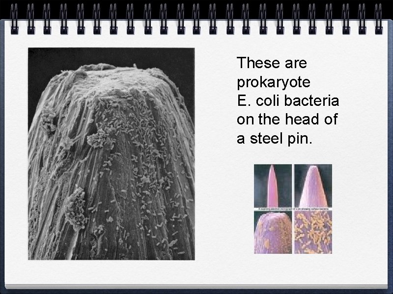 These are prokaryote E. coli bacteria on the head of a steel pin. 