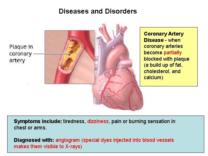 Diseases and Disorders Coronary Artery Disease - when coronary arteries become partially blocked with