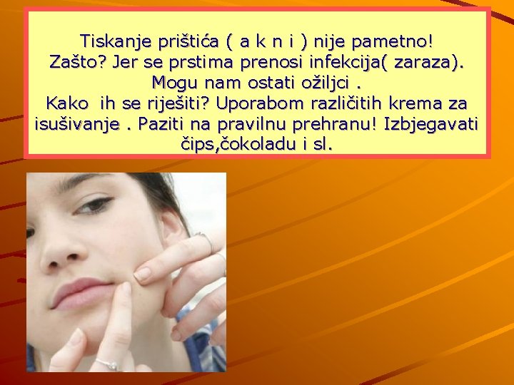 Tiskanje prištića ( a k n i ) nije pametno! Zašto? Jer se prstima