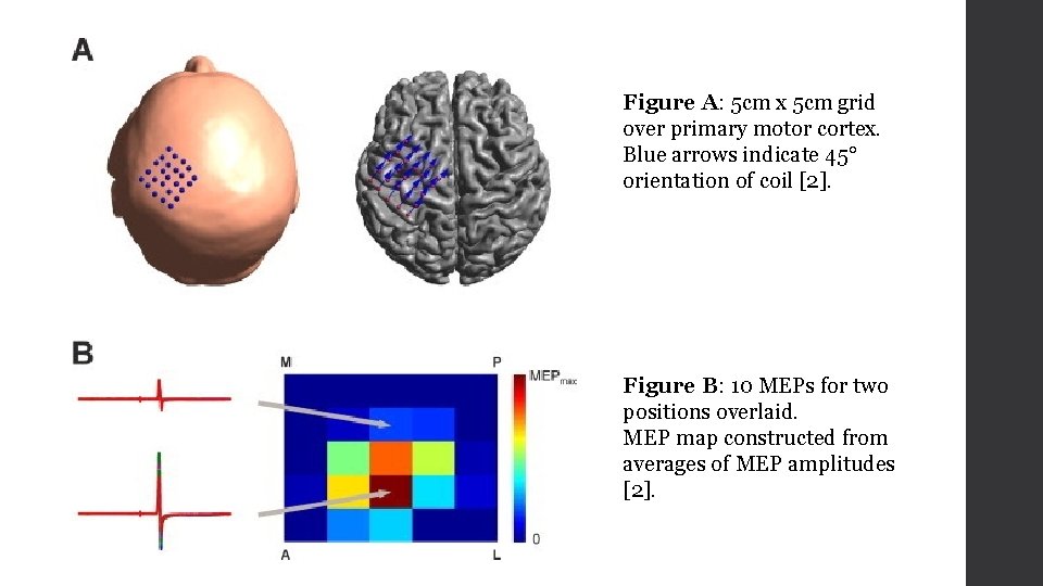 Figure A: 5 cm x 5 cm grid over primary motor cortex. Blue arrows