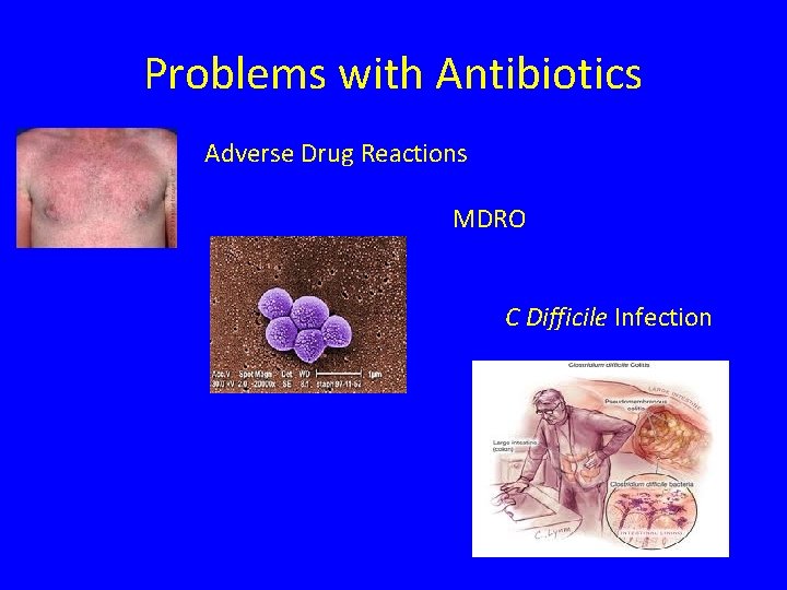 Problems with Antibiotics • Adverse Drug Reactions MDRO C Difficile Infection 