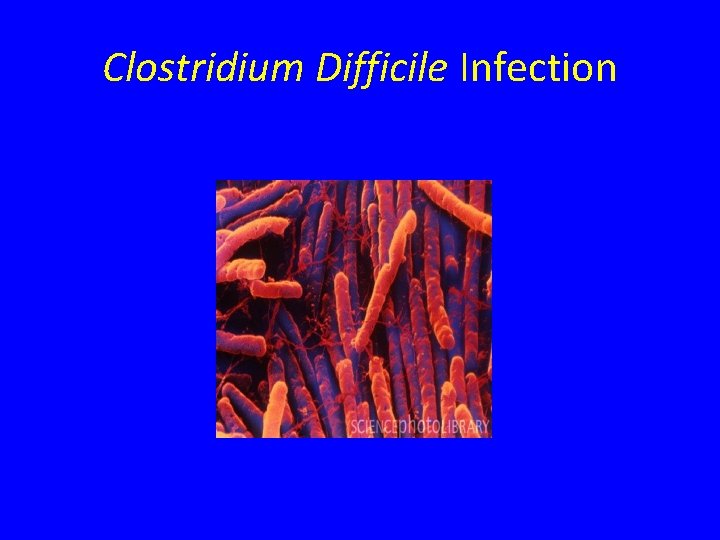 Clostridium Difficile Infection 