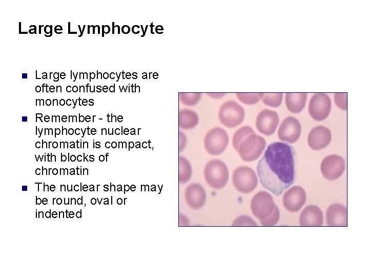 Large Lymphocyte n n n Large lymphocytes are often confused with monocytes Remember -