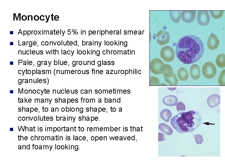Monocyte n n n Approximately 5% in peripheral smear Large, convoluted, brainy looking nucleus