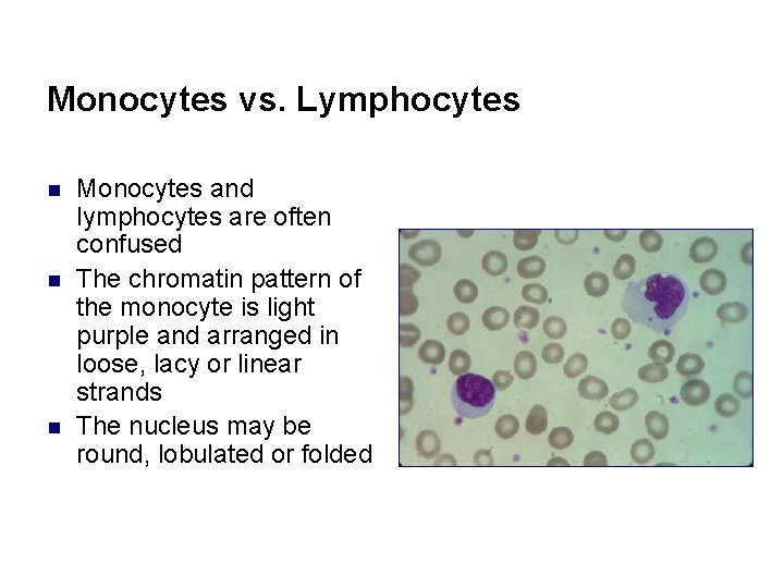 Monocytes vs. Lymphocytes n n n Monocytes and lymphocytes are often confused The chromatin