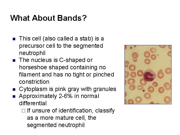 What About Bands? n n This cell (also called a stab) is a precursor