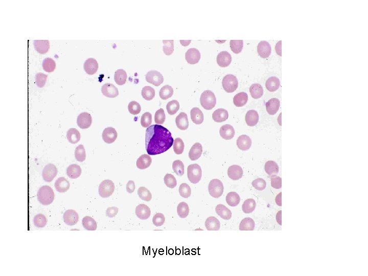 Myeloblast 