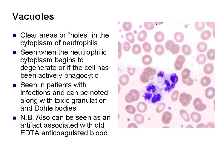 Vacuoles n n Clear areas or “holes” in the cytoplasm of neutrophils Seen when