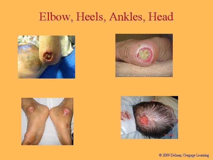 Elbow, Heels, Ankles, Head © 2009 Delmar, Cengage Learning 