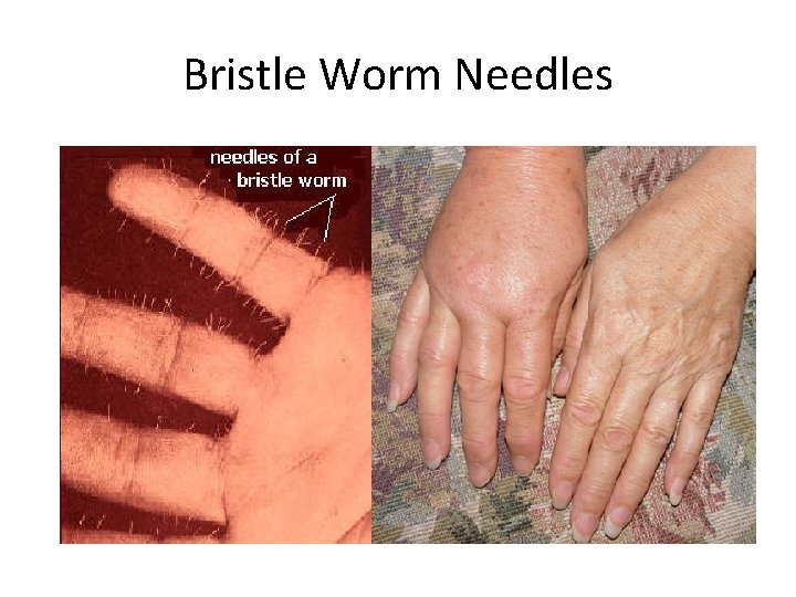 Bristle Worm Needles 
