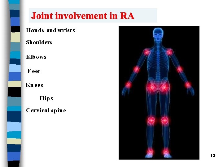 Hands and wrists Shoulders Elbows Feet Knees Hips Cervical spine 13 