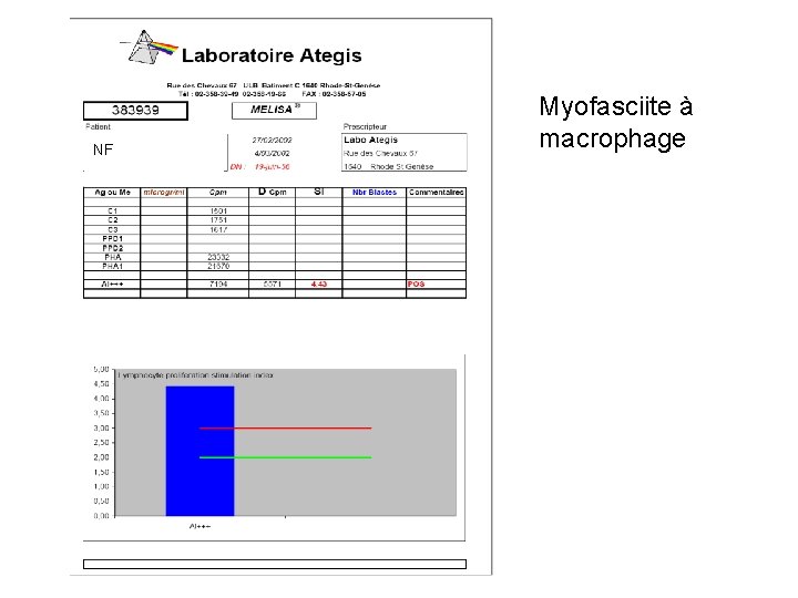 NF Myofasciite à macrophage 