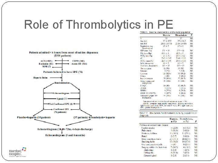 Role of Thrombolytics in PE 