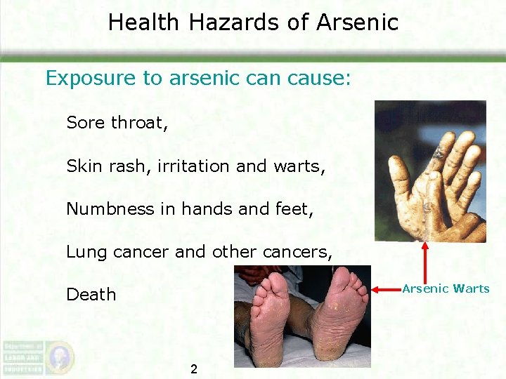 Health Hazards of Arsenic Exposure to arsenic can cause: Sore throat, Skin rash, irritation Health Hazards of Arsenic Exposure to arsenic can cause: Sore throat, Skin rash, irritation