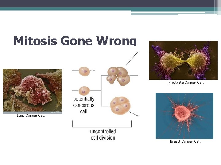 Mitosis Gone Wrong Prostrate Cancer Cell Lung Cancer Cell Breast Cancer Cell 