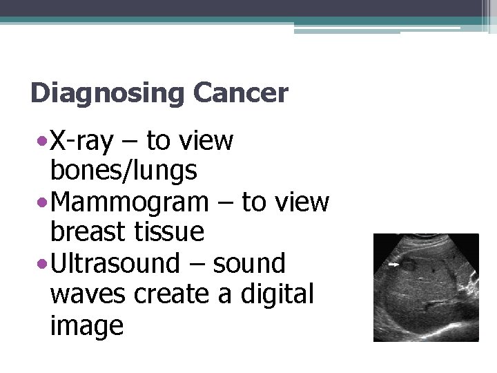 Diagnosing Cancer • X-ray – to view bones/lungs • Mammogram – to view breast