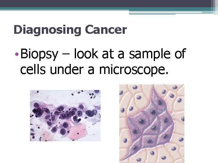 Diagnosing Cancer • Biopsy – look at a sample of cells under a microscope.