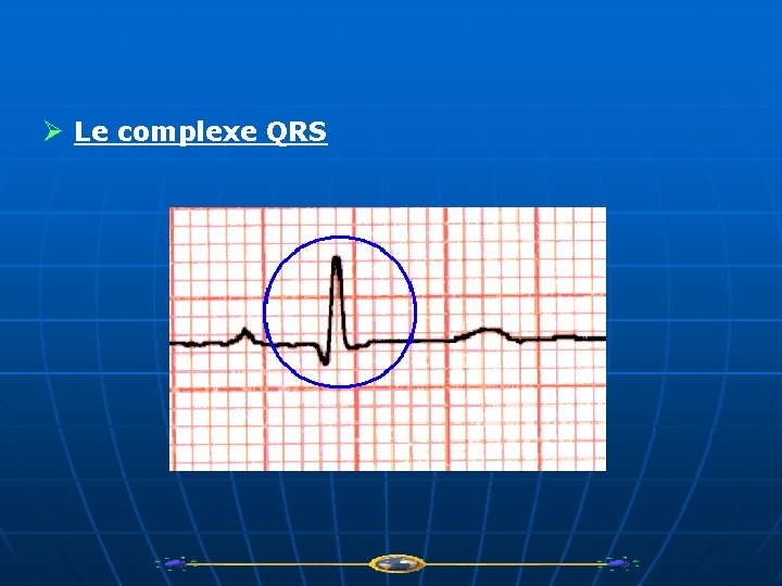 Ø Le complexe QRS 