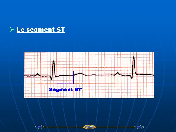 Ø Le segment ST 