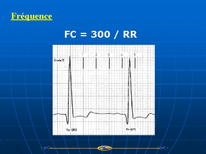 Fréquence FC = 300 / RR 