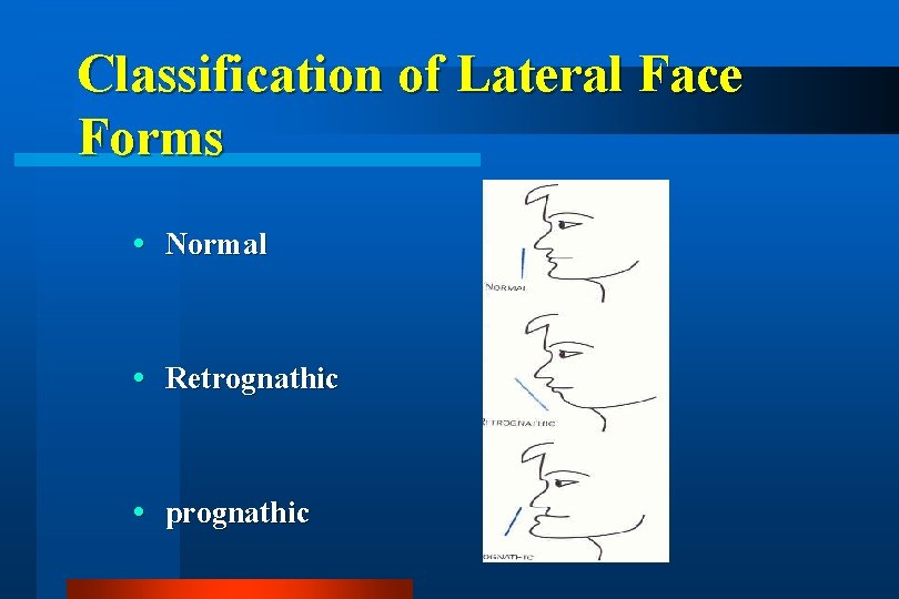 Classification of Lateral Face Forms Normal Retrognathic prognathic 