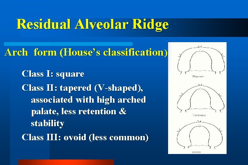 Residual Alveolar Ridge Arch form (House’s classification) Class I: square Class II: tapered (V-shaped),