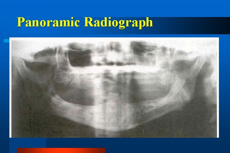 Panoramic Radiograph 