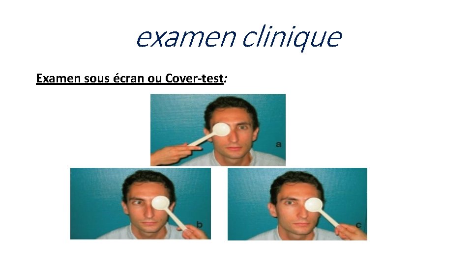 examen clinique Examen sous écran ou Cover-test: 