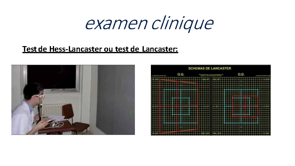 examen clinique Test de Hess-Lancaster ou test de Lancaster: 
