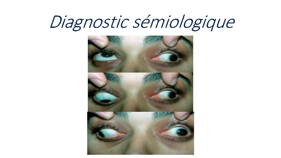Diagnostic sémiologique 