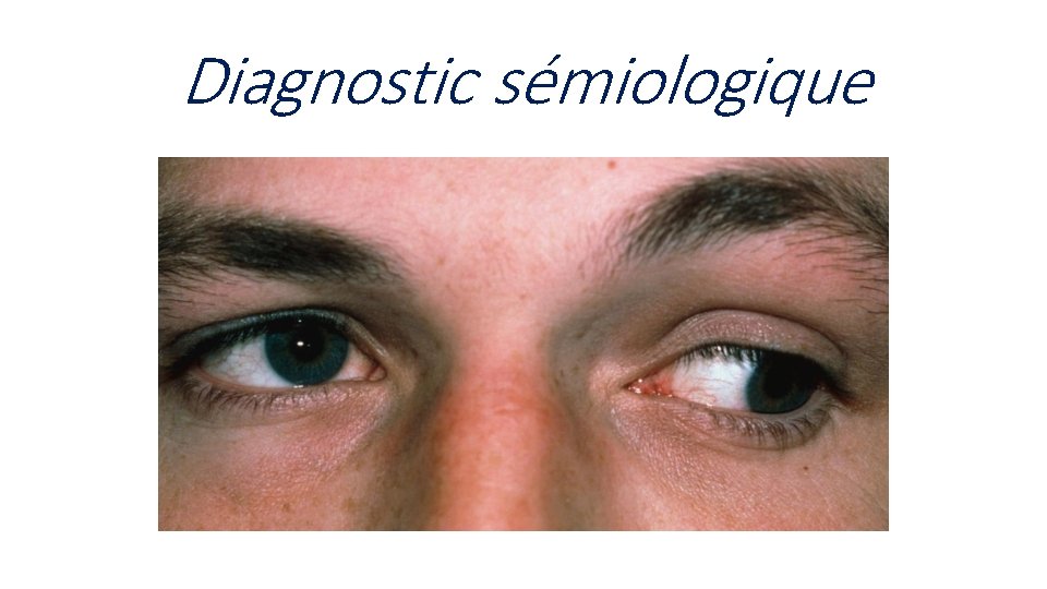 Diagnostic sémiologique 