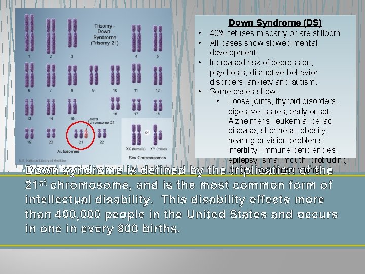 Down Syndrome (DS) • • 40% fetuses miscarry or are stillborn All cases show