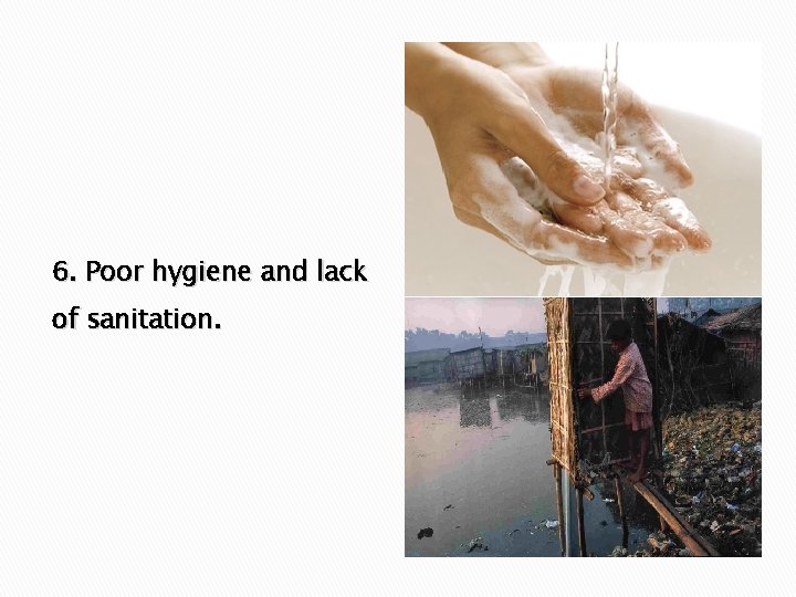 6. Poor hygiene and lack of sanitation. 