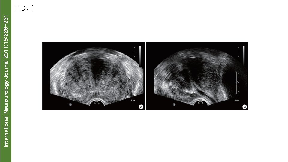 International Neurourology Journal 2011; 15: 228 -231 Fig. 1 