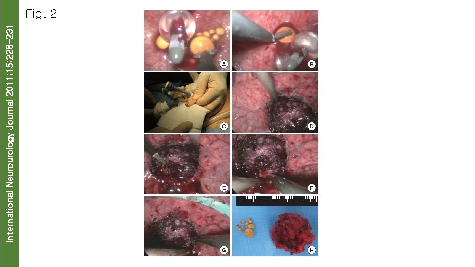 International Neurourology Journal 2011; 15: 228 -231 Fig. 2 