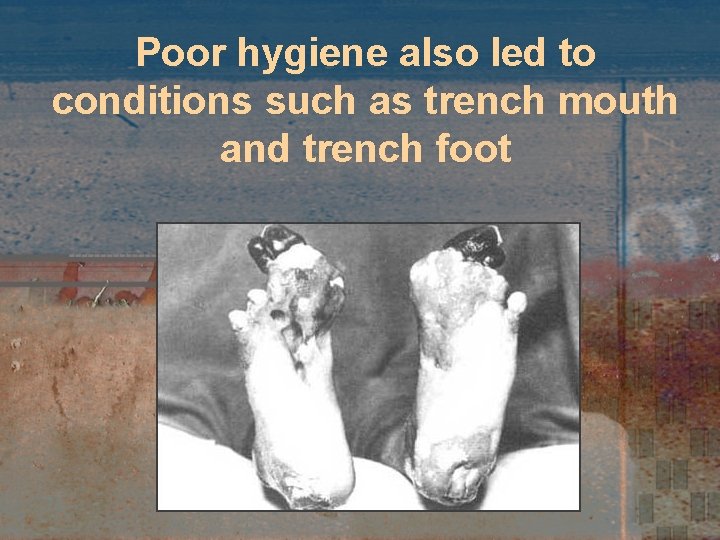 Poor hygiene also led to conditions such as trench mouth and trench foot 