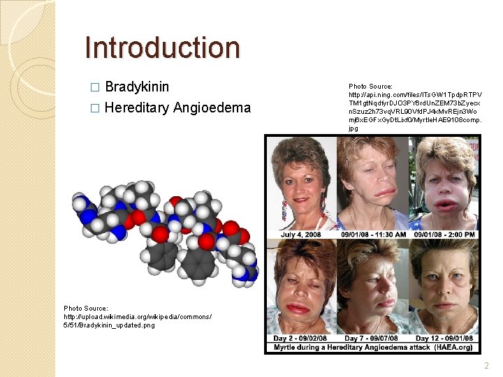 Introduction Bradykinin � Hereditary Angioedema � Photo Source: http: //api. ning. com/files/l. Ts. GW