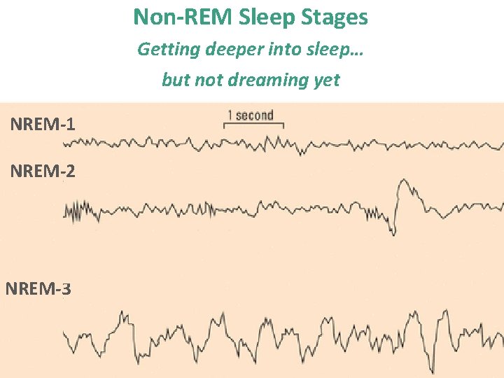 Non-REM Sleep Stages Getting deeper into sleep… but not dreaming yet NREM-1 NREM-2 NREM-3