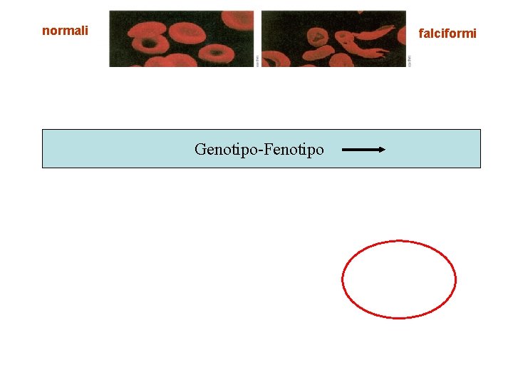 normali falciformi Genotipo-Fenotipo 