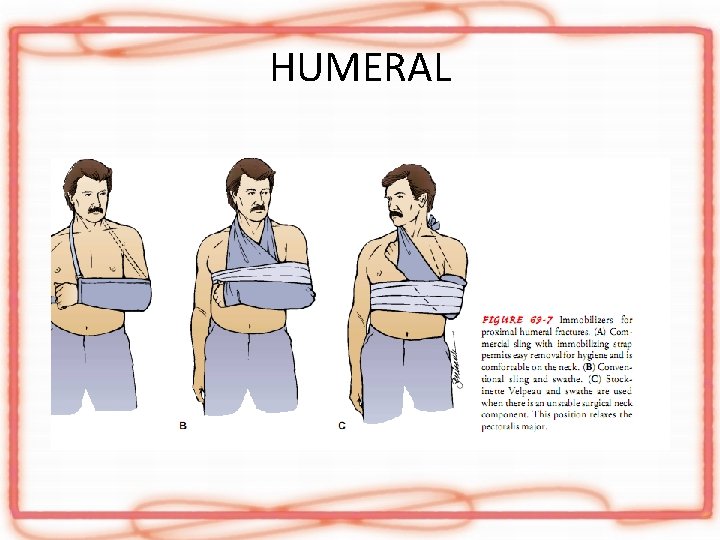 HUMERAL 