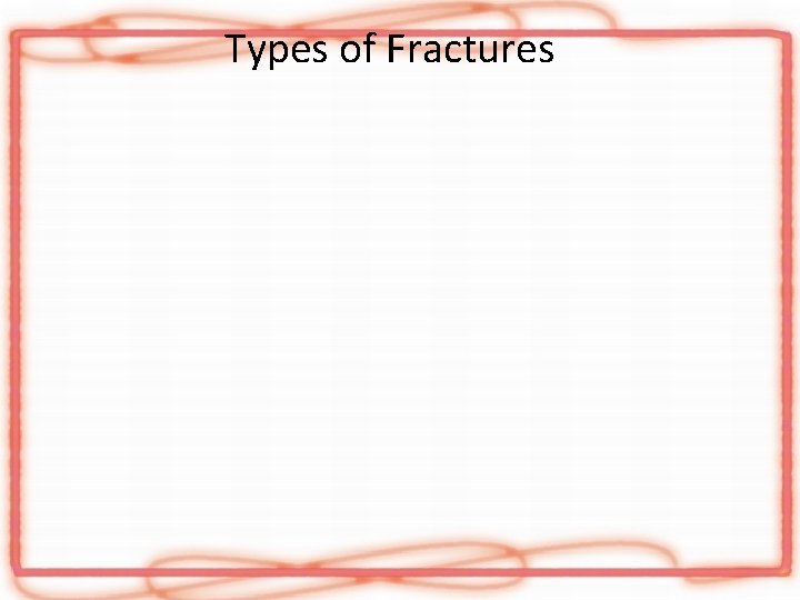 Types of Fractures 