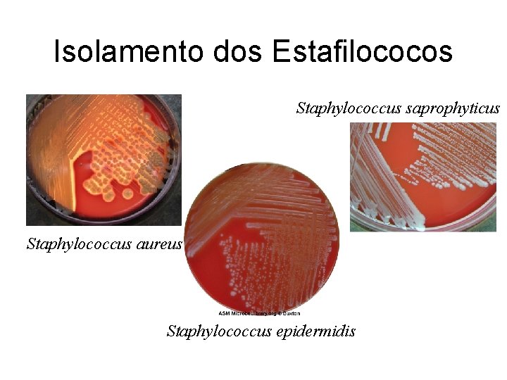 Isolamento dos Estafilococos Staphylococcus saprophyticus Staphylococcus aureus Staphylococcus epidermidis 