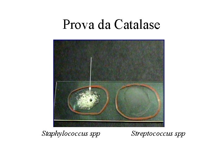 Prova da Catalase Staphylococcus spp Streptococcus spp 