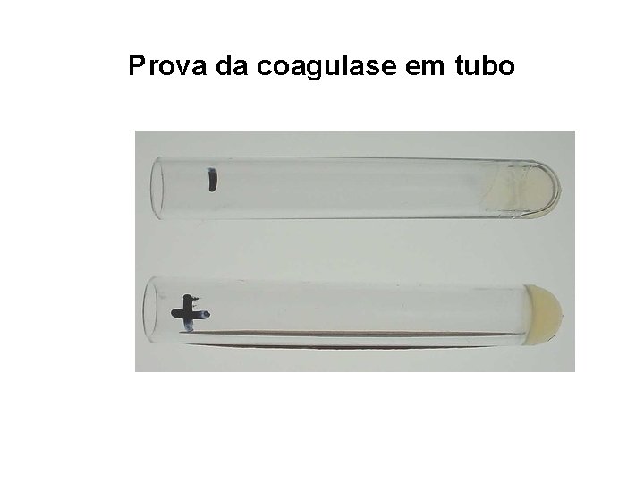 Prova da coagulase em tubo 