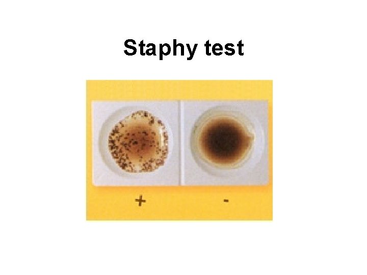 Staphy test 