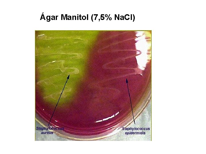 Ágar Manitol (7, 5% Na. Cl) 