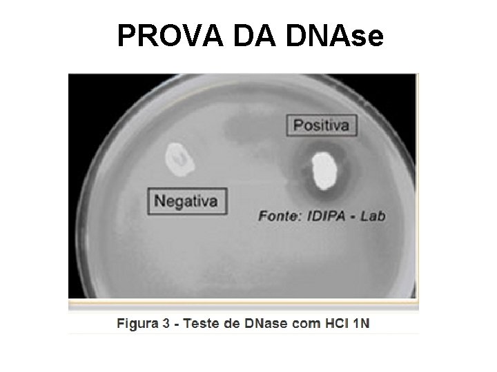 PROVA DA DNAse 