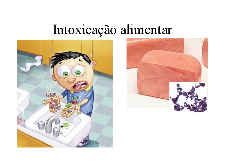 Intoxicação alimentar 