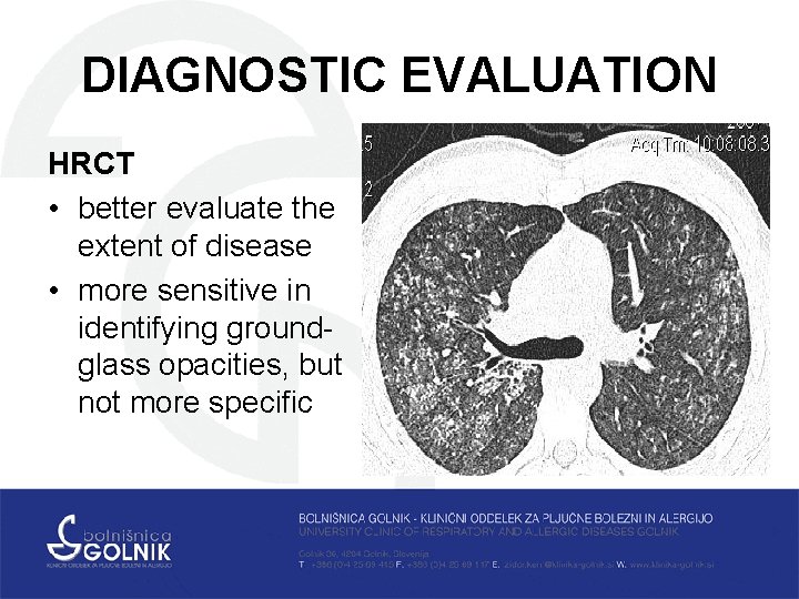 DIAGNOSTIC EVALUATION HRCT • better evaluate the extent of disease • more sensitive in